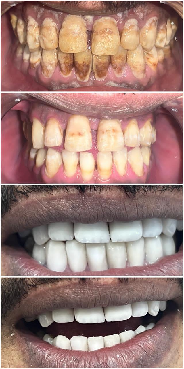 تصفية وتنظيف